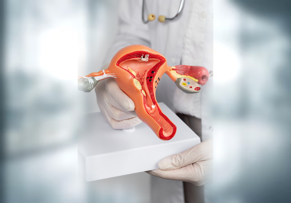 What Is ACL Reconstruction?