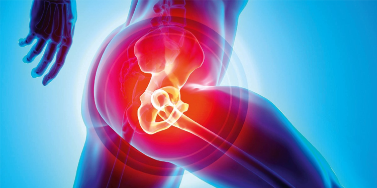 All you need to know about Hip Replacement