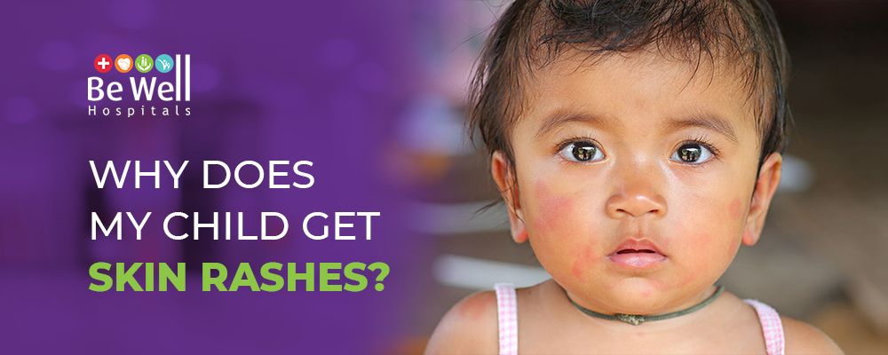 WHY DOES MY CHILD GET SKIN RASHES ?