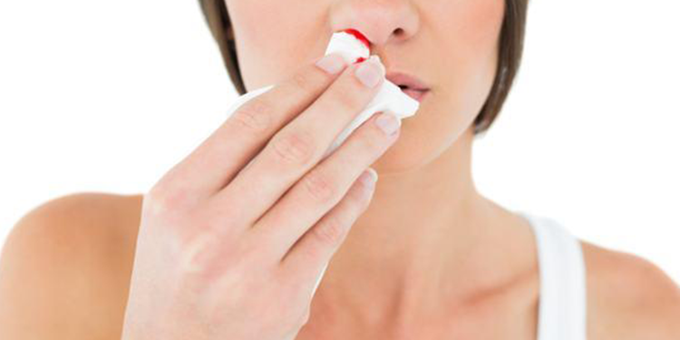 All you need to know about Nose Bleeding