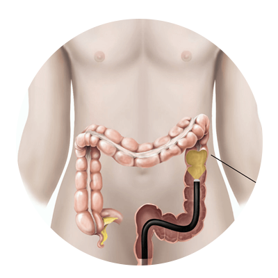 gastroenterology hospital in chennai