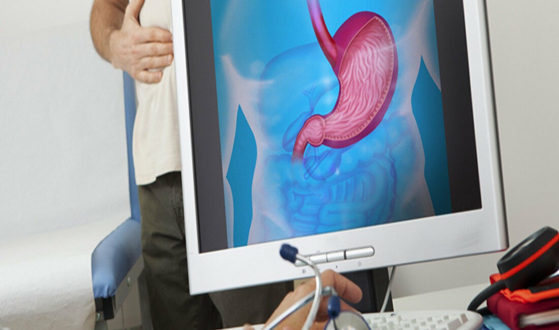 Gastroenterology Hospital in Chennai | Gastroenterology Treatment in Chennai