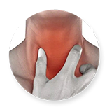 hernia surgery in chennai