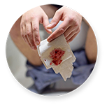 fistula surgery cost in chennai