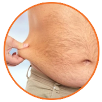 Liposuction